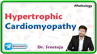 9 Hypertrophic Cardiomyopathy Pathology USMLE Step 1 [upl. by Assenad614]