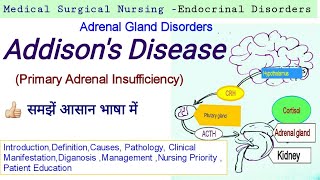 Addisons Disease Causes symptoms TreatmentNursing Priority NursingCrash AddisonianCrisis [upl. by Dmitri540]