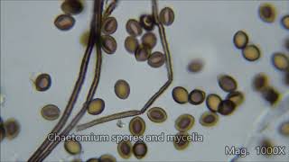 Toxic House Mold Under the Microscope [upl. by Ikey402]