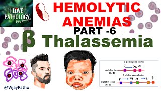 Hemolytic Anemias Part 6 Beta Thalassemia Pathogenesis types Diagnosis amp Treatment [upl. by Htiffirg]