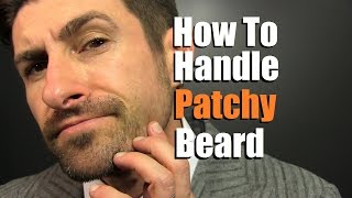 How To Deal With A Patchy Beard  Bald Spot Reduction Tips [upl. by Venus]