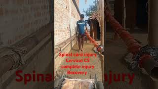 Spinal cord injury C5 Cervical Complete injury motivation Recovery Three years [upl. by Emerson]