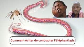 Comment éviter de contracter léléphantiasis [upl. by Llerrud]