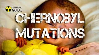 Chernobyl Mutations in Humans and Children of Chernobyl [upl. by Edita581]