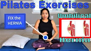 Parastomal Hernia Repair � Best Techniques Kristi Harold MD [upl. by Milzie]