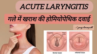 ACUTE LARYNGITISगले में खराश होनाA YOUNG HOMOEOPATH [upl. by Boutis]