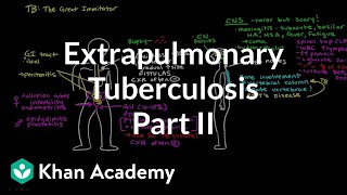 Extrapulmonary TB Part 2  Infectious diseases  NCLEXRN  Khan Academy [upl. by Hnilym]