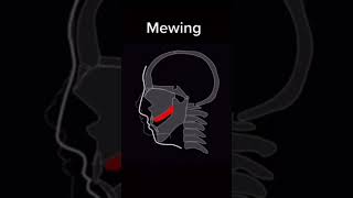 how mewing correctly changed my face 🔥 [upl. by Sikata665]