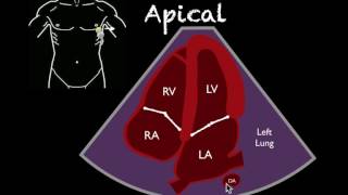 Bedside Ultrasound Basic Cardiac US [upl. by Digirb]