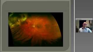 Optos Webinar How I made my optomap a success Implementation into independent optometry practices [upl. by Nangem817]