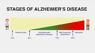 Diagnosing Alzheimer’s Disease [upl. by Chavaree]