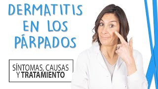 Dermatitis en los Párpados  Síntomas Causas y Tratamiento [upl. by Enailuj]