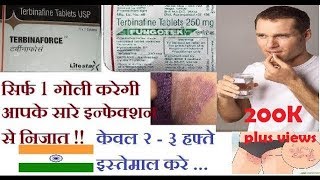 Terbina force Tablet Review in Hindi [upl. by Olds]