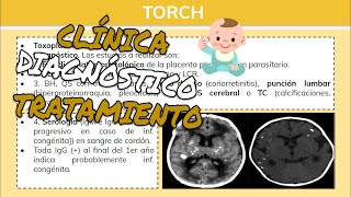 ⚕️🩺 Infecciones Congénitas TORCH TOXOPLASMOSIS Y SÍFILIS Síntomas Diagnóstico y Tratamiento [upl. by Yehtomit238]