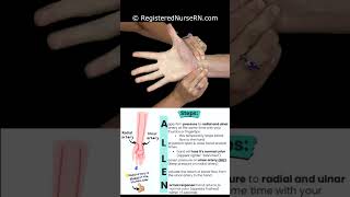 Modified Allen Test Demonstration amp Nursing Mnemonic nursing nurse rn nursingschool [upl. by Josefa]