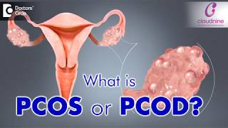 What is PCOS or PCOD  Dr Bandita Sinha of Cloudnine Hospitals  Doctors Circle [upl. by Wendye]