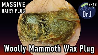 Woolly Mammoth Wax Plug  Hearing Loss  4KHD [upl. by Lauree]