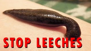 How to stop Leeches [upl. by Georgy]