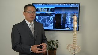 What is a Herniated Disc Symptoms amp Treatment Options Explained by Dr Rey Bosita [upl. by Yehudit627]