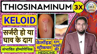 Thiosinaminum3X Use in Hindi Keloid homoeopathic treatmentसर्जरी हो या घाव के दाग धब्बे का इलाज [upl. by Adnorehs]