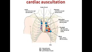 Cardiac auscultations for signs of cardiovascular diseases  Areas of Auscultation [upl. by Kalinda337]