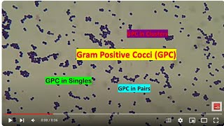 Gram Positive cocci in Singles Pairs and Clusters of Staphylococcus epidermidis [upl. by Adnelg272]