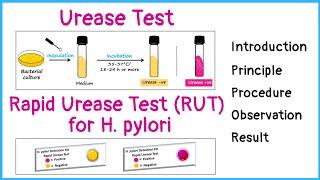 Urease test for identification of bacteria  Rapid urease test for H pylori  Principle  Procedure [upl. by Henghold]