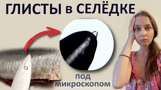 Множество паразитов в солёной селёдке Как такое есть [upl. by Jaco168]