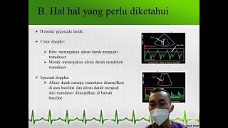 usg doppler quotvena hepatikaquot [upl. by Felix]