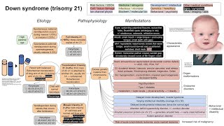 Down syndrome trisomy 21 mechanism of disease [upl. by Willy]