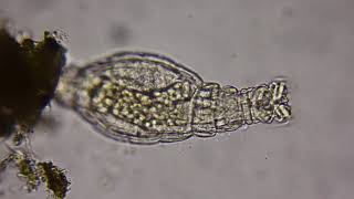 Rotifer under a microscope [upl. by Notgnillew]