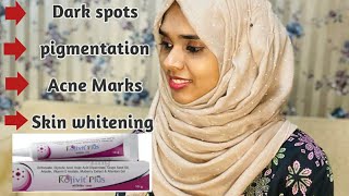 kojivit plus cream review Malayalam  Skin whitening  side effects how to use our life and pharma [upl. by Froehlich]