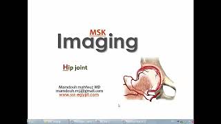 Imaging of the Hip joint DRE Prof Mamdouh Mahfouz [upl. by Ykcir]