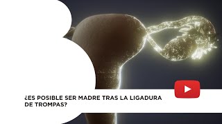 ¿Es posible ser madre tras la ligadura de trompas [upl. by Ungley]