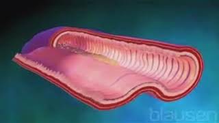 Trastornos gastrointestinales Parte 1 [upl. by Lamson]