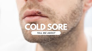 Cold Sores [upl. by Vasos]