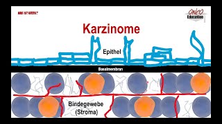 Krebsarten  Karzinome Sarkome etc [upl. by Tobey]