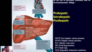 Pathophysiology of liver  part3 [upl. by Goldston]