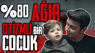 OTİZM GEÇİCİ Mİ  OTİZM EĞİTİM [upl. by Melleta]