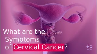 What are the Symptoms of Cervical Cancer [upl. by Ttesil851]