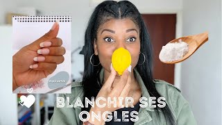 5 ASTUCES POUR BLANCHIR SES ONGLES [upl. by Yadsnil]