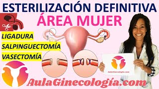 ESTERILIZACIÓN DEFINITVA LIGADURA DE TROMPAS y OTRAS RIESGOS y MÉTODO  Ginecología y Obstetricia [upl. by Arianie222]