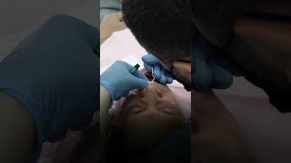 Watch the transformation after dental bonding shorts [upl. by Annyahs]