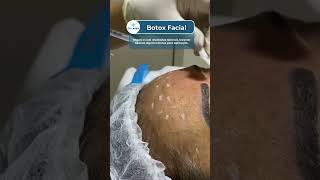 Botox Facial na CR Laser® [upl. by Imorej]