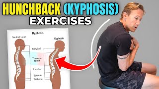 How to Improve Your MidBack Posture Thoracic Kyphosis Exercises [upl. by Bakeman]