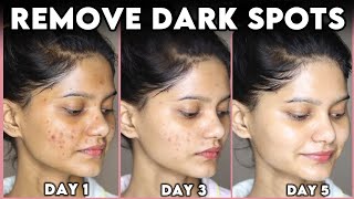 Remove Dark SPOTS amp Pimples MARKS Permanently  How to Use 24k Kumkumadi Thailam by Tribe Concepts [upl. by Niarda]