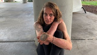 Ariel  How I Became a Drug Addict  Miami Homeless Drug Addict Interview [upl. by Stella]