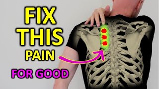 Fix Rhomboid Pain For Good Shoulder Blade Pain [upl. by Blythe]