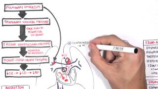 Pulmonary Embolism PART I Overview [upl. by Chrysa586]