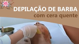 Como Fazer Depilação de Barba com Cera [upl. by Etnovert]